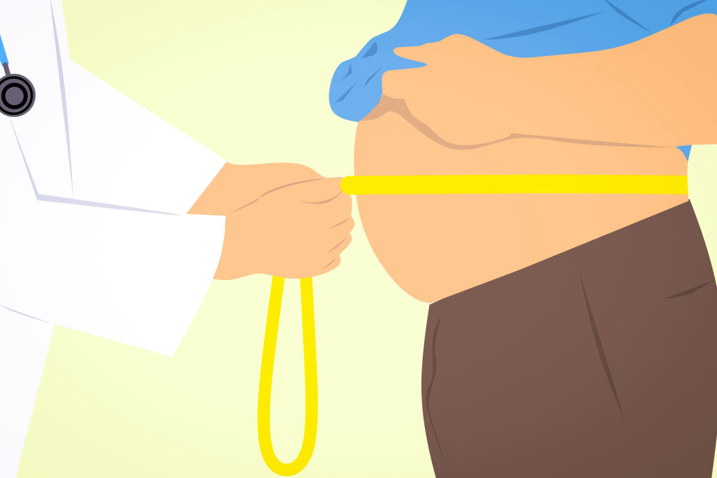 Psicologia Bariátrica e técnicas cirúrgicas disponíveis para o tratamento da obesidade - NeuroFlux