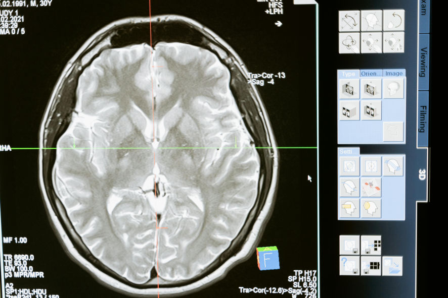 Neurodesenvolvimento e saúde mental  - NeuroFlux